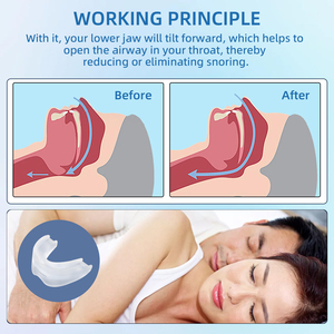 Customizable Adjustability Snore Relief Mouthpiece Comfortable Moldable Snore Mouth Guard for Better <strong>Sleep</strong> at Night - Product Image 4