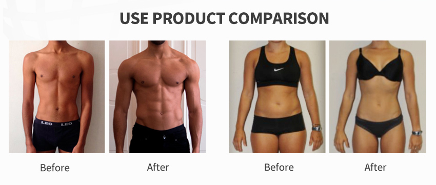 EMS Slimming Device For Home Use EMS Slimming Device For Home Use