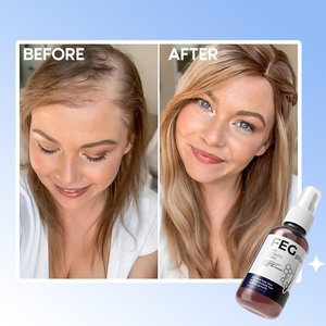 FEG <strong>Plus</strong> Natural Herbal Hair Care Essence Private Label Hair <strong>Growth</strong> Serum - Product Image 3