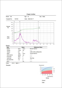 Güçlü tıbbi kablosuz İdrar testi ölçüm analiz uroflowmetri testi Hindi Uro akış ölçer testi üroloji Uroflowmeter metre