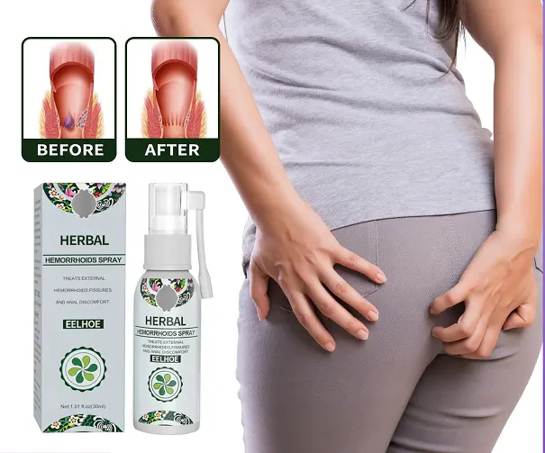 Hemorrhoids Spray Anal Bleeding Swelling Anal Fissure Relief Pain Hemorrhoids Spray