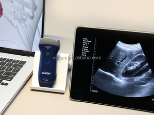 MSK <span class=keywords><strong>ultrasound</strong></span> adalah integral dari penilaian neuromusculette komprehensif untuk memandu rencana perawatan rehabilitasi - Product Image 3