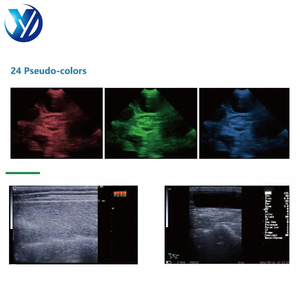 5.6 inch LED hiển thị y tế động vật Chế độ quét lồi mảng dòng mảng lồi đầu dò siêu âm thú y hệ thống chẩn đoán - Product Image 5