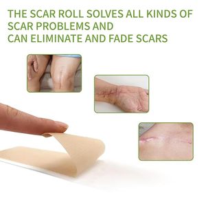 Silicone vết sẹo tấm (1.6x120 Roll-3M) y tế có thể giặt tái sử dụng cho c-phần phẫu thuật ghi sẹo lồi mụn loại bỏ tấm - Product Image 5