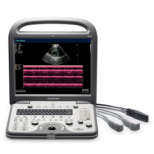 2024 terbaru dokter hewan sonobape S8V Ultrasound Doppler warna portabel untuk penggunaan dokter hewan - Product Image 1