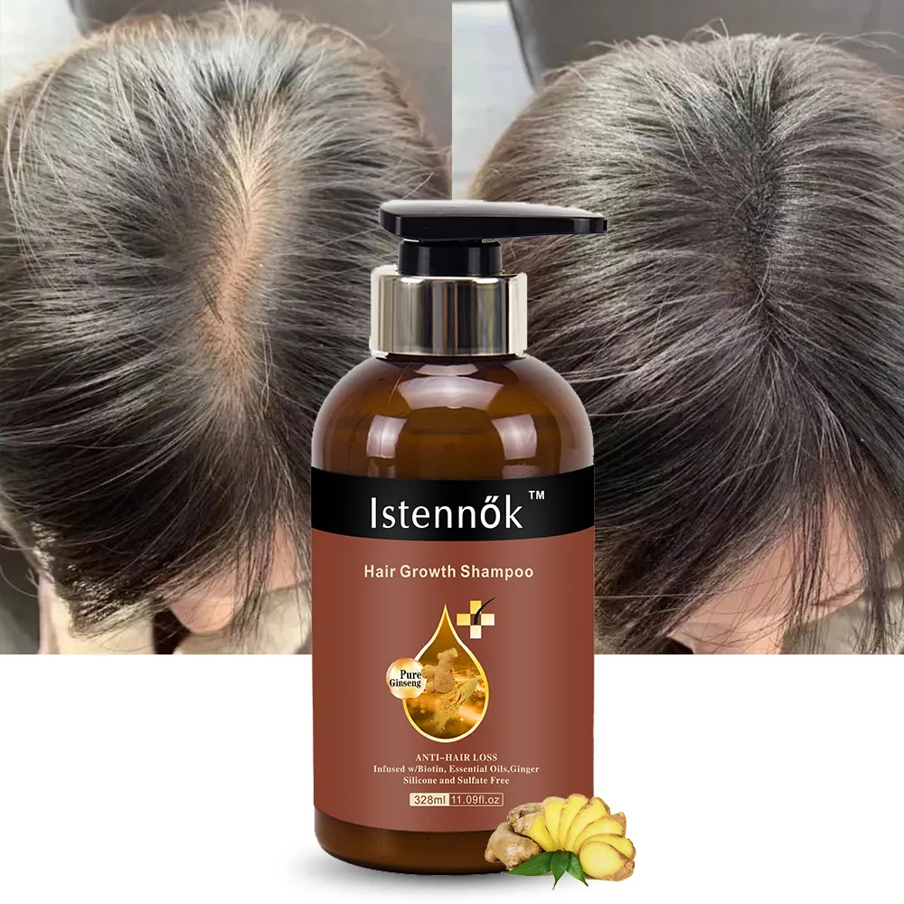 Aceite de menta de Romero Istennok tratamiento Calvo biotina champús de regeneración del cabello para mujeres ANE hombres