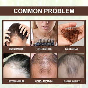OTVENAプライベートラベルオーガニックアンチヘアロスセラムフォールエクストラストレングスヘアグロースオイル - Product Image 6