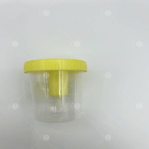 Oem Dùng Một Lần 120Ml Chân Không Kín Nước Tiểu Container Tùy Chỉnh Y Tế Mẫu Cup PP PS Vật Liệu Nhựa Phòng Thí Nghiệm Nguồn Cung Cấp - Product Image 1