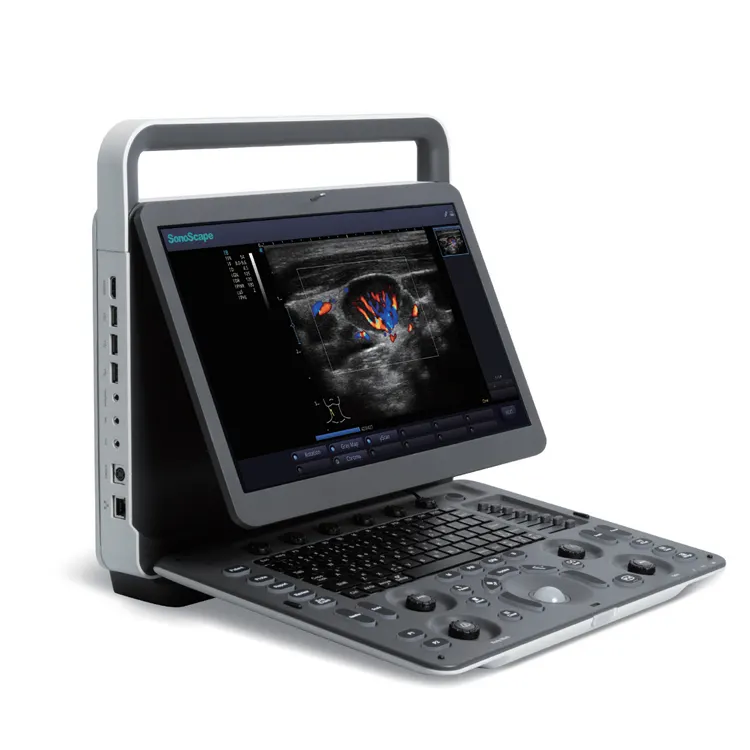 Preço mais barato SonoScape E1exp Ultrassom Portátil Máquina Color Doppler Ultrasound Scanner