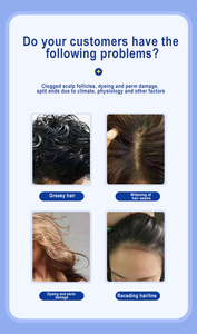 2025 kafa derisi cilt analiz makinesi saç folikülü yağı nem kafa derisi bakımı dedektörü saç büyüme tedavisi kafa derisi analizi tedavisi - Product Image 3