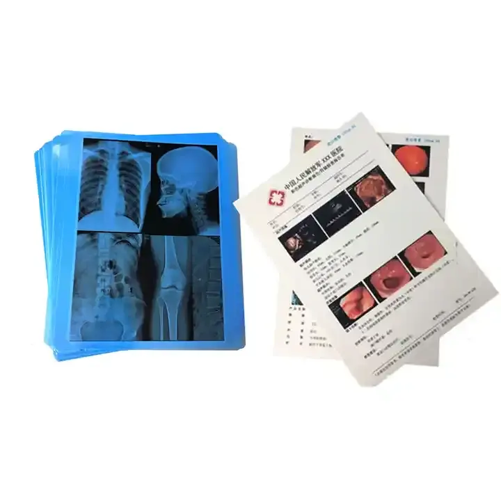 Medical Xray Film Inkjet Film For inkjet printer White Blue X Ray Film