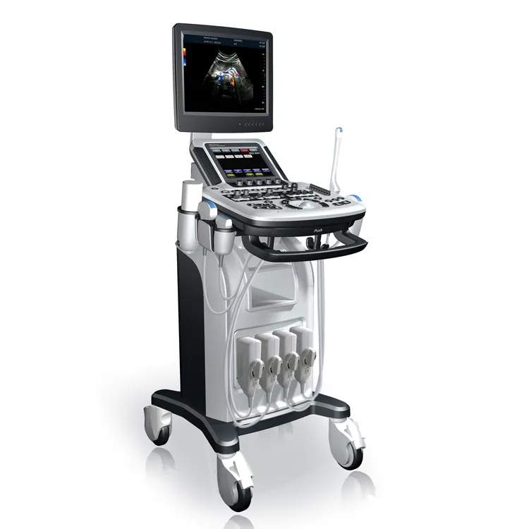 Mejor máquina de ultrasonido de embarazo, escáner 4d