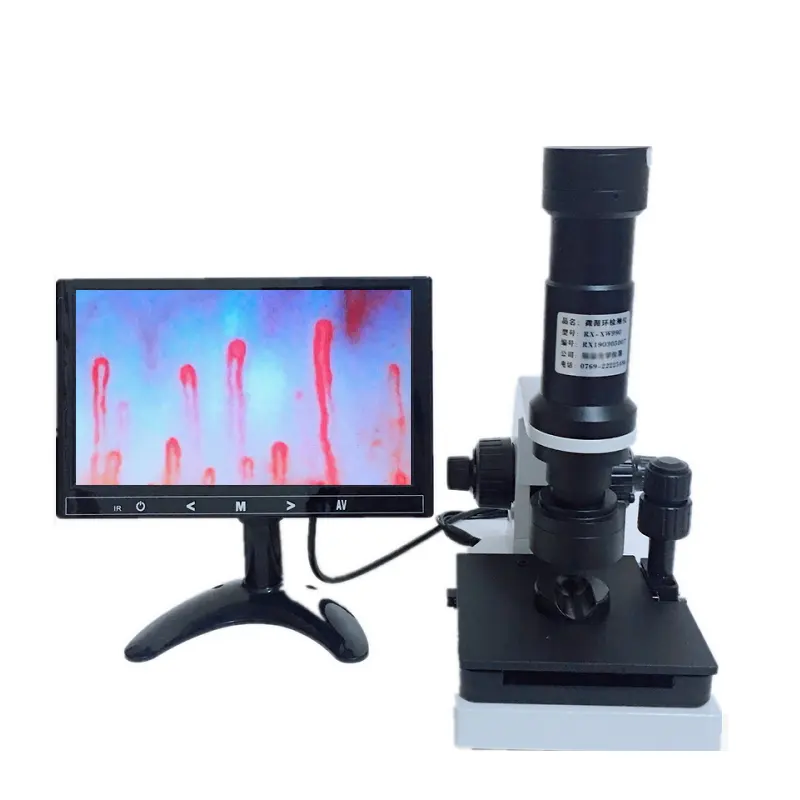 थोक पोर्टेबल माइक्रोस्कोप केशिका रक्त Microcirculation में Capillaroscopy प्रदर्शन NailFold वीडियो का नेतृत्व किया