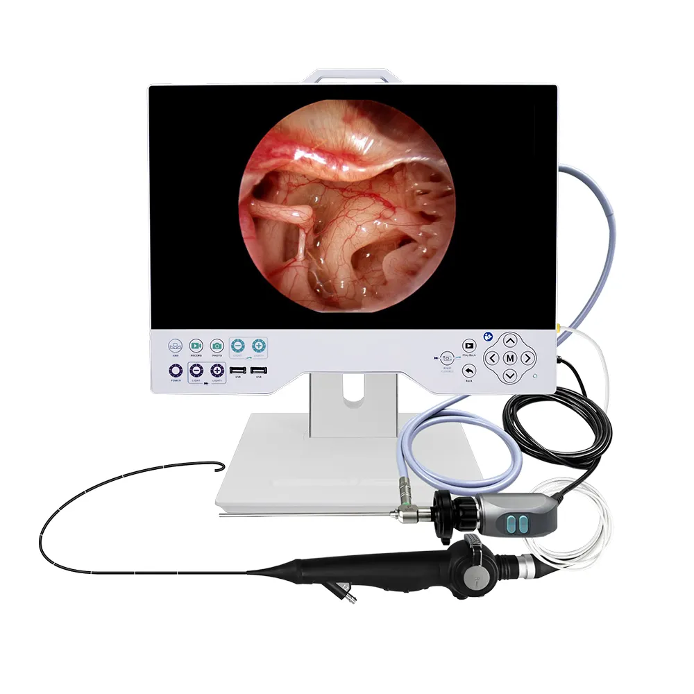 15.6 pollici tutto In uno videoregistratore integrato LED sorgente di luce fredda macchina fotografica endoscopio portatile laparoscopia FHD