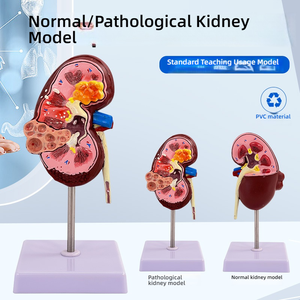 病気の腎臓と尿システムをシミュレートする人間の教育のための解剖学的PVC腎臓モデル