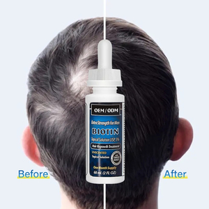 Hızlı saç büyüme ürün 5% saç büyüme Serum damlalıklı 60ml saç büyüme yağı