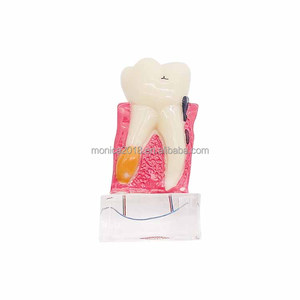 歯科医学教育歯教育モデル神経モデルで歯周4倍人間の歯モデル - Product Image 2