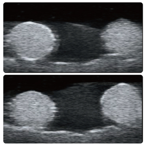 Ultrasound Training Phantom IG018-S1 Stone-Insertable Bile Duct Pathological Wall Lesions Biliary Ultrasound Anatomy Simulator - Product Image 4