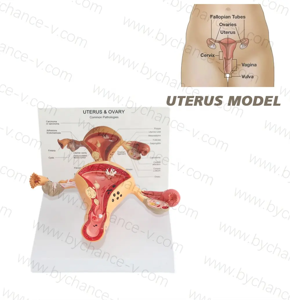 Mô hình giải phẫu cơ quan sinh sản nữ Mô hình giải phẫu tử cung người