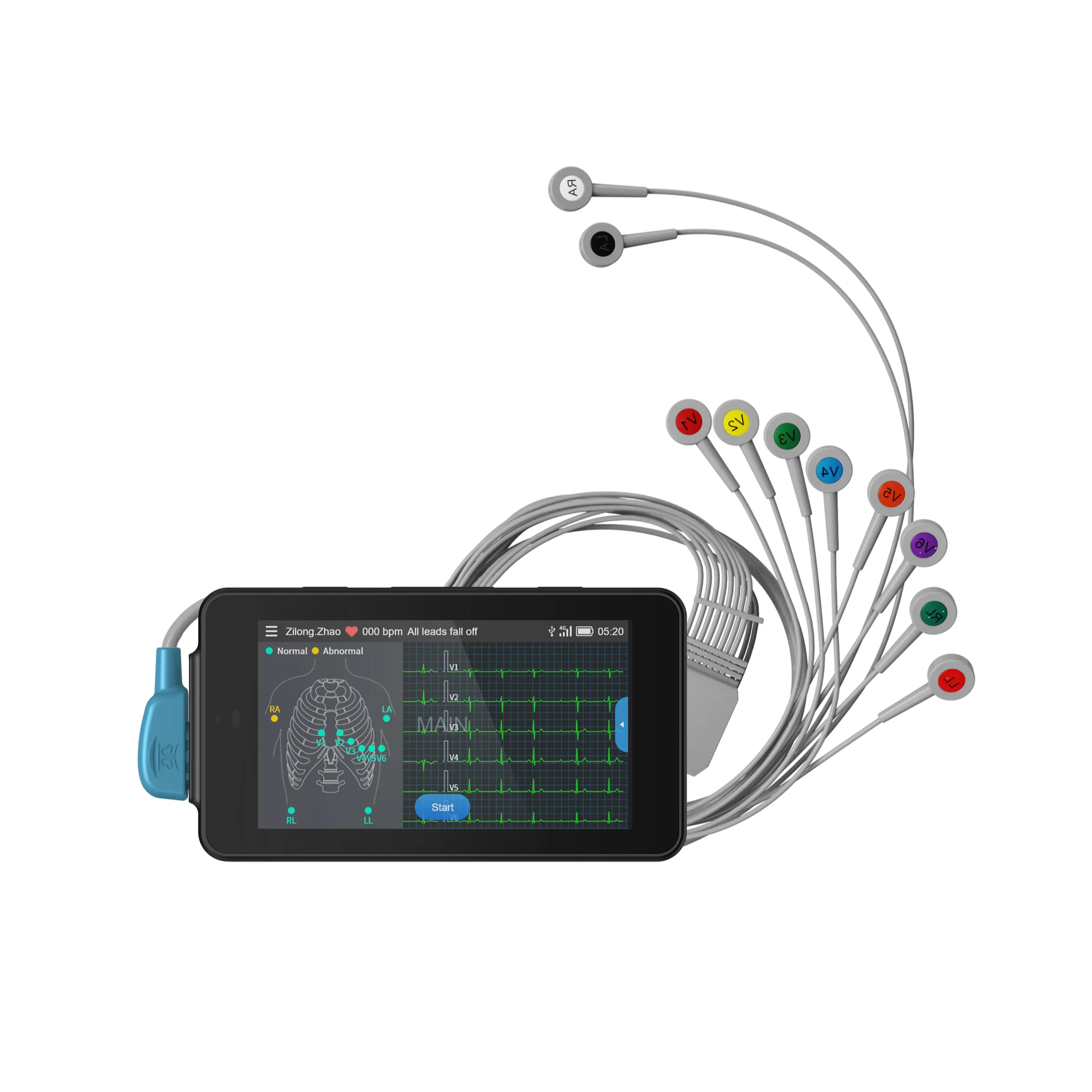 24 horas Monitor de mano Ecg portátil La mejor opción portátil EKG ECG inalámbrico