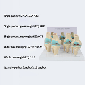 SCIEDU Teaching Resource Medical <strong>Human</strong> 4-stage Knee Joint Model with <strong>Back</strong> Card Diseased Knee Joint Model - Product Image 6