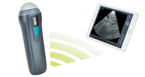 Machine à ultrasons vétérinaire Ecografo Portatil Veterinaria Handheld Mini Doppler couleur linéaire Wifi Scanner à ultrasons sans fil - Product Image 2