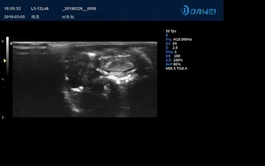Dawei-sistema ultrasónico de Color para uso veterinario, imagen en tiempo Real 4d portátil de alta gama - Product Image 6