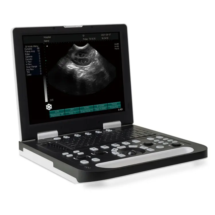 Ruisheng grande prestazioni portatile touch screen vet macchina scanner ad ultrasuoni per animali domestici