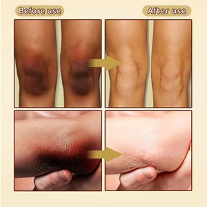 कोरिया कॉस्मेटिक्स त्वचा की देखभाल गोरा करने वाली, आसानी से काले घुटनों, कोहनी, मजबूत तत्काल गोरा करने वाली क्रीम से छुटकारा पाएं - Product Image 4