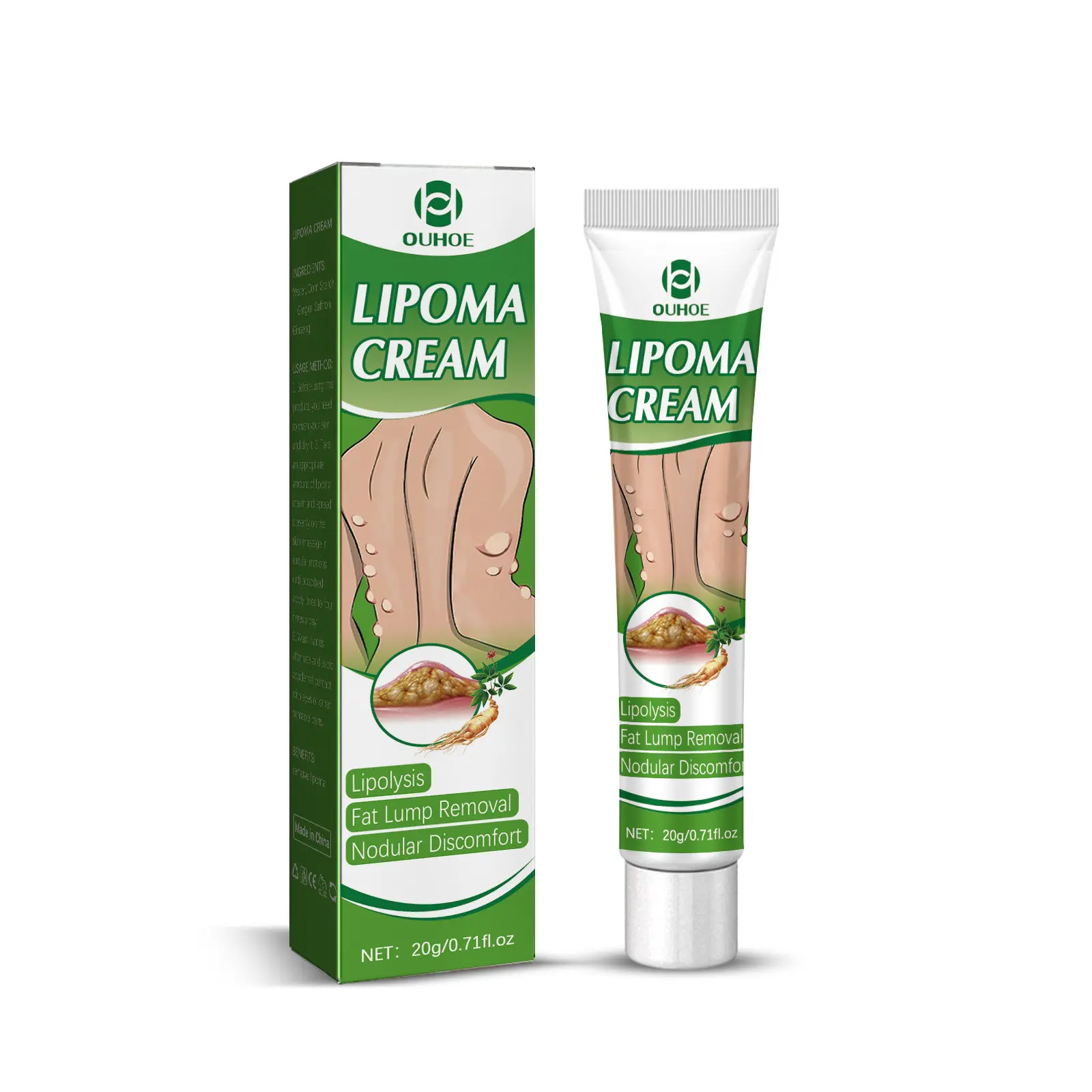 Lipoma Soothing Ointment、Lumpfree、Skin Cure Swelling Cream
