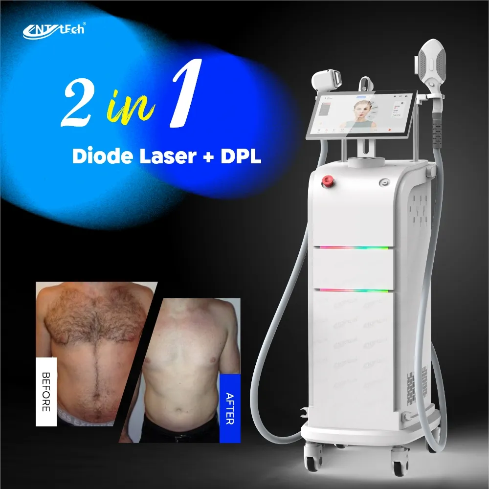 Nhà Máy bán hàng trực tiếp 550Nm DPL Nir siêu Photon DPL OPT Diode Máy tẩy lông bằng laser trẻ hóa da