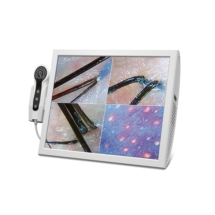 White hair analyzer -JC062