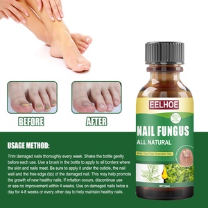 เล็บเท้าต้นชาเชื้อราน้ำมัน Onychomycosis ฆ่าเชื้อการแก้ปัญหาการดูแลเท้า - Product Image 2