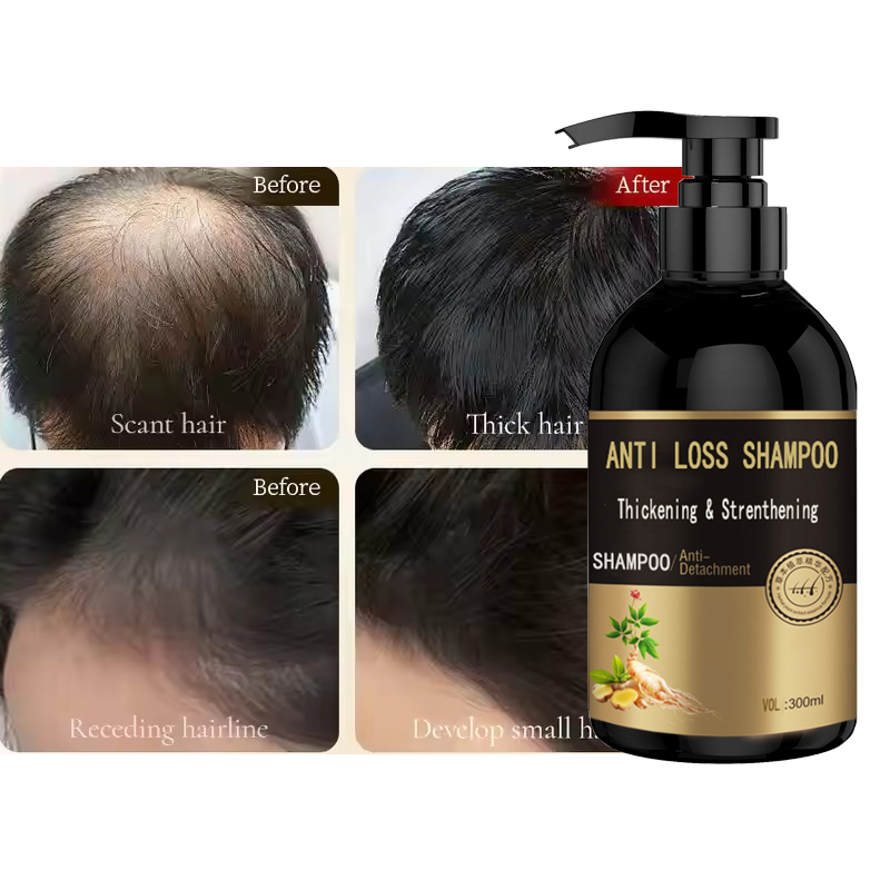 shampoing anti-perte