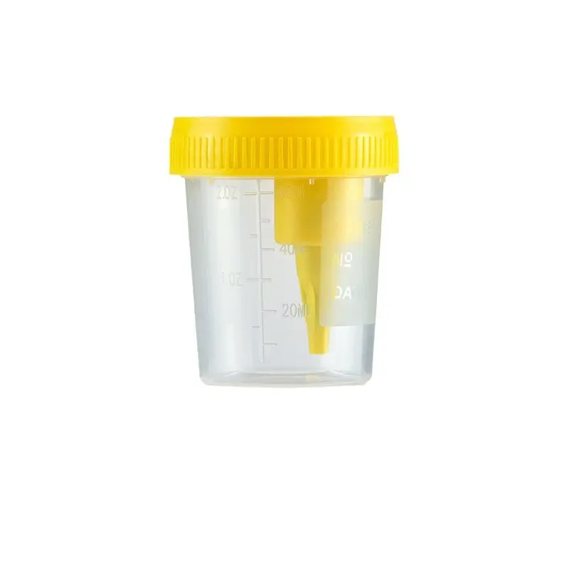 Nieuw Binnen 90Ml Vacuüm Urine Beker Met Naaldschroefdeksel Pp Specimen Beker