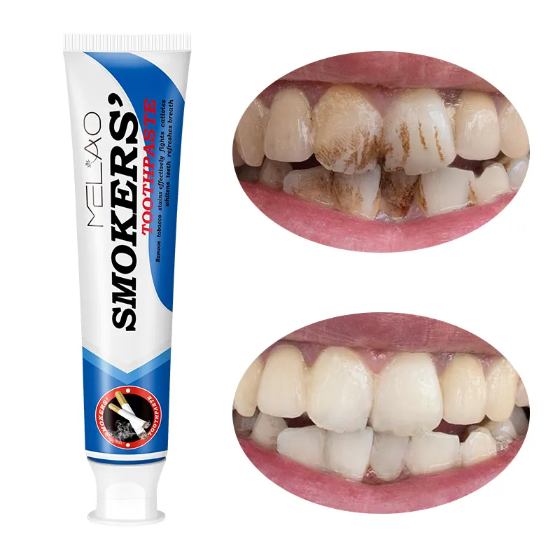 Commercio all'ingrosso Vegan Herbal dentifricio fumatori macchie rimuovere sbiancamento denti dentifricio bianco fumatori dentifricio