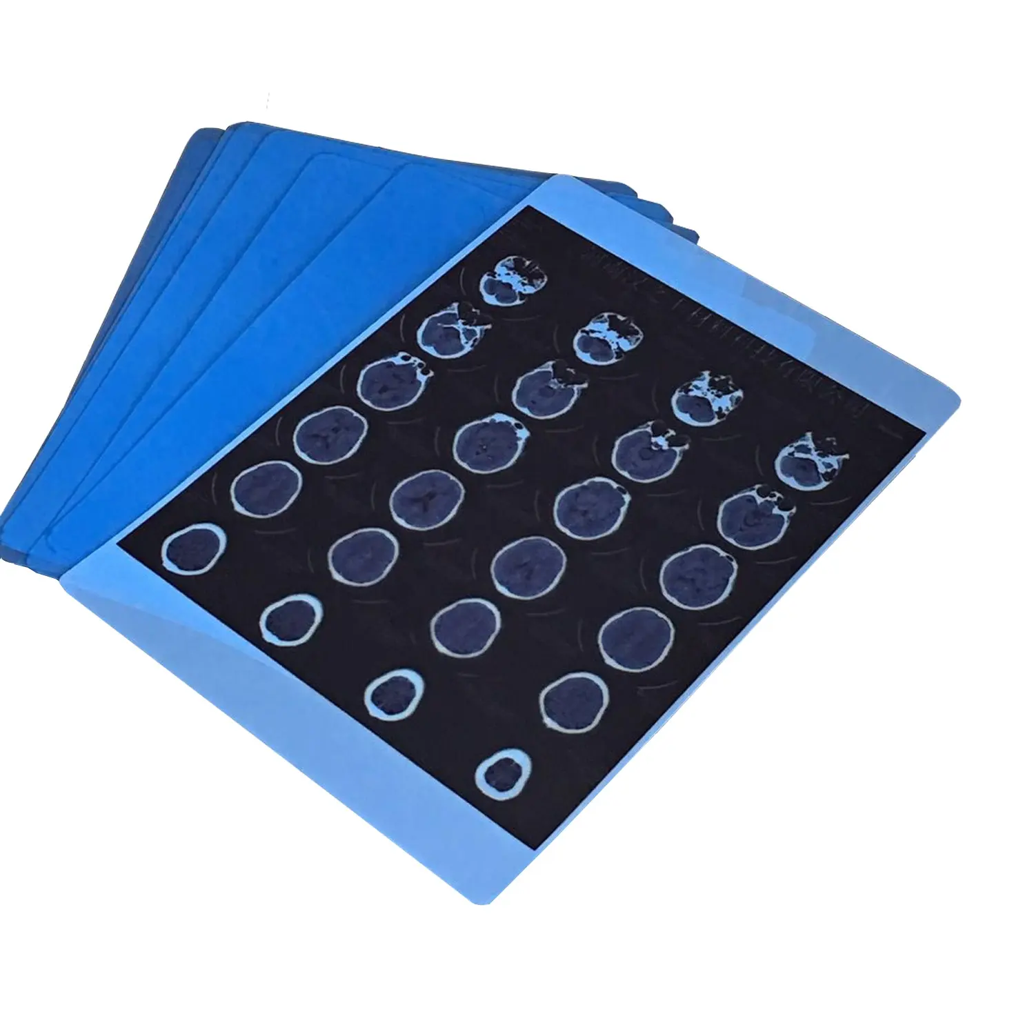 ब्लू Inkjet मेडिकल एक्स-रे फिल्म चिकित्सा सूखी फिल्म A4 A3 चादरें