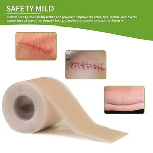 Silicone vết sẹo tấm (1.6x120 Roll-3M) y tế có thể giặt tái sử dụng cho c-phần phẫu thuật ghi sẹo lồi mụn loại bỏ tấm - Product Image 2
