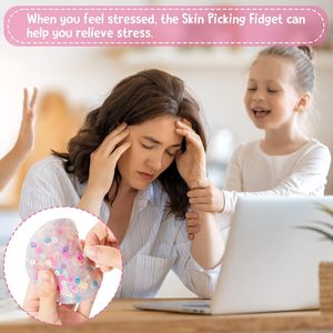 Cilt toplama stres oyuncakları cilt toplayıcıları duyusal Trichotillomania oyuncak Toy tillomania dehb ve <span class=keywords><strong>OCD</strong></span> Fidget anksiyete stres giderici oyuncak