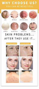 Xà Phòng Hữu Cơ Tự Nhiên 100% Xà Phòng Làm Trắng Da Làm Đẹp Thủ Công Bán Sỉ - Product Image 6