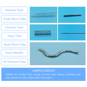 หลอดไทเทเนียมนิกเกิล <span class=keywords><strong>carotid</strong></span> stenting หลอดช่องท้องท่อจมูกเครื่องตัดเลเซอร์ - Product Image 6