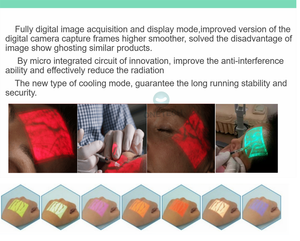 Vf12 דק נייד עבור גלאי ורידים מילוי עבור paediatary הזרקה תוך ורידי בוגר neonatal - Product Image 3