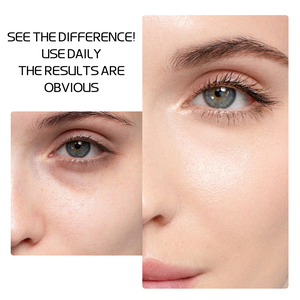 ODM 30ml sıradan cilt bakımı beyazlatma yüzeysel soyma formülasyonu yüz Serum orijinal sıvı laktik asit 5% + Ha 2%