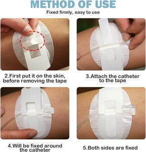 ISO bersertifikat pita kaki Nephrostomy pria stiker merekat sendiri pembalut luka untuk kateter memperbaiki tas urin Foley pemegang EOS - Product Image 6