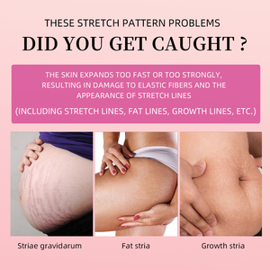 OEM ODM Organic Beste Schwangerschaft Anti-Falten-Schönheits aufhellung Feuchtigkeit spendend Glatt Entfernen Sie die Narben entfernung Anti-Stretch-Mark-Creme - Product Image 2