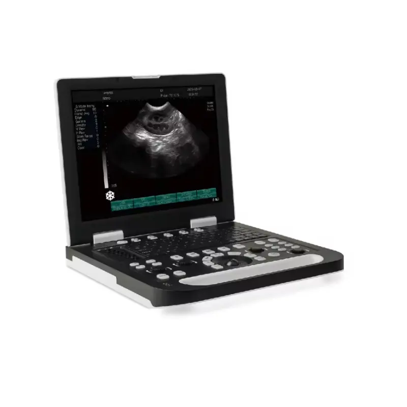 Nuevo ultrasonido Doppler color portátil médico para hospital