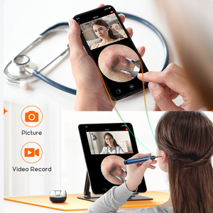 Bebird Note5 Pro 3-in-1 aile doktor Mini otoskop kamera ile ağrısız kulak temizleyici aracı - Product Image 6