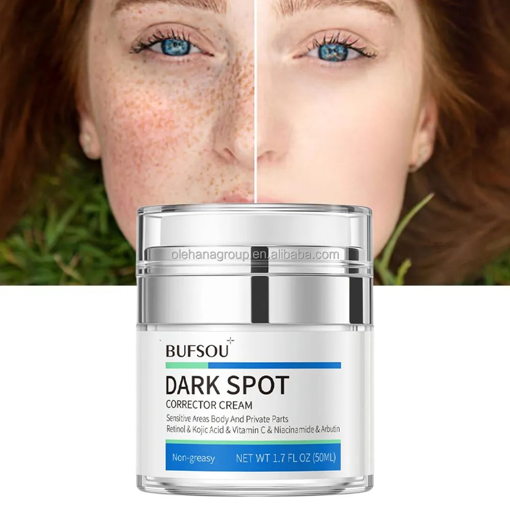 New Strong Pimples Melasma Blemish Removal 7 Days Dark Spot Corrector Skin Care Private Label Whitening Freckle Face Cream