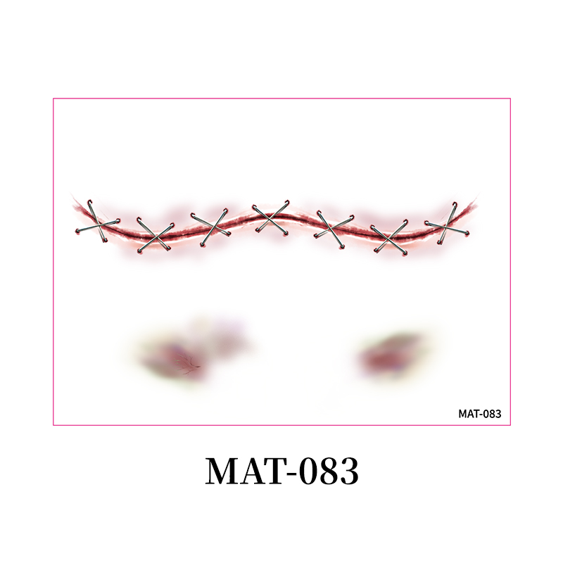 MAT-083