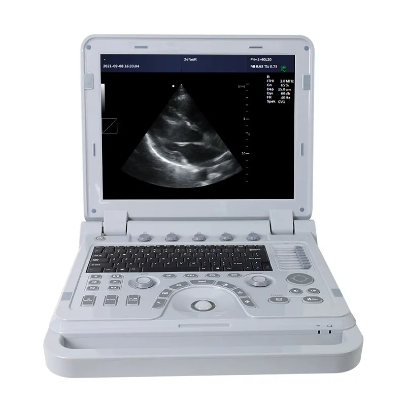CONTEC Portable Machine Color Doppler Ultrasound Scanner abdominal Convex+ Linear Probe CMS1700B